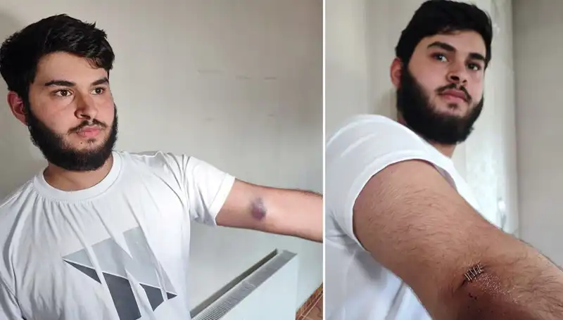 Bahçeye Kaçan Top, Mahalleyi Karıştırdı: Conoların Kamyonetiyle Büyüyen Komedi